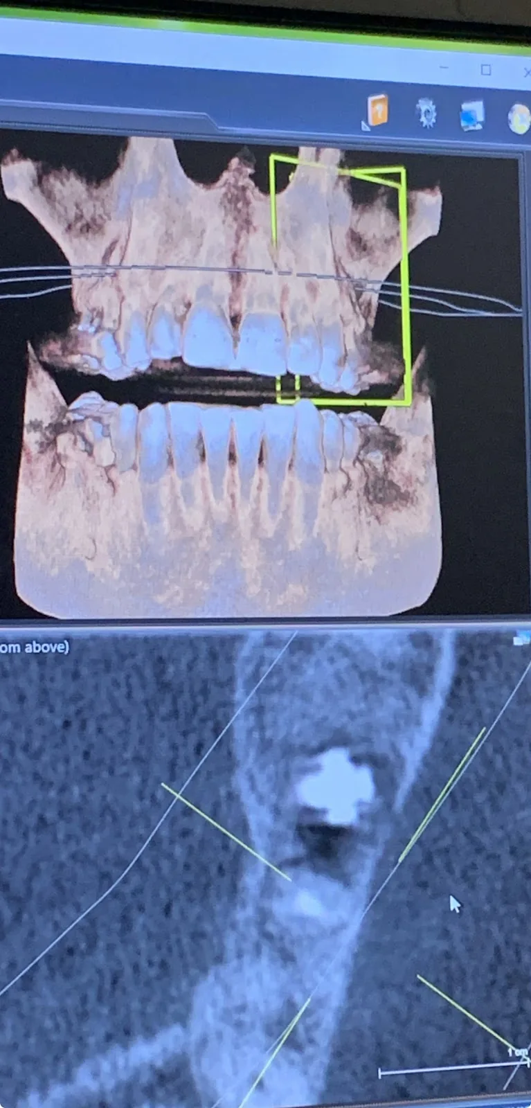 Beverly Hills Periodontics & Dental Implant Center photo 5