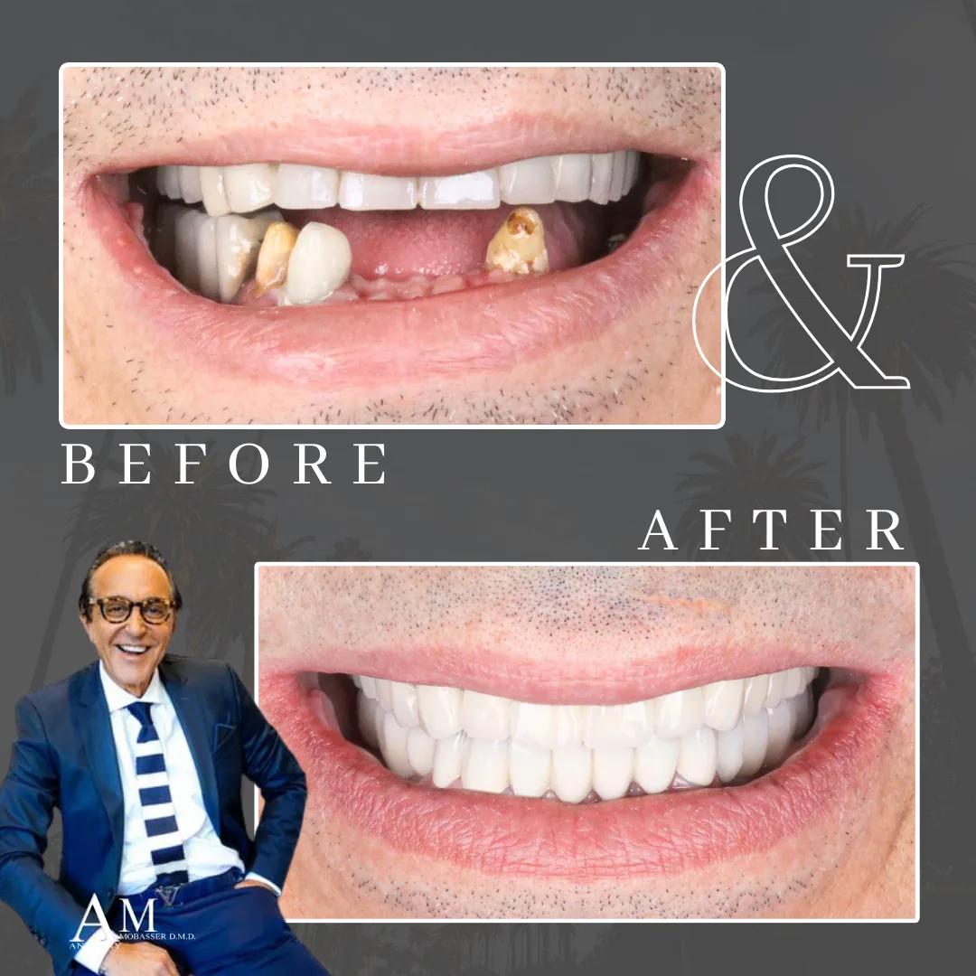 Dr. Anthony Mobasser — Celebrity Dentist photo 2