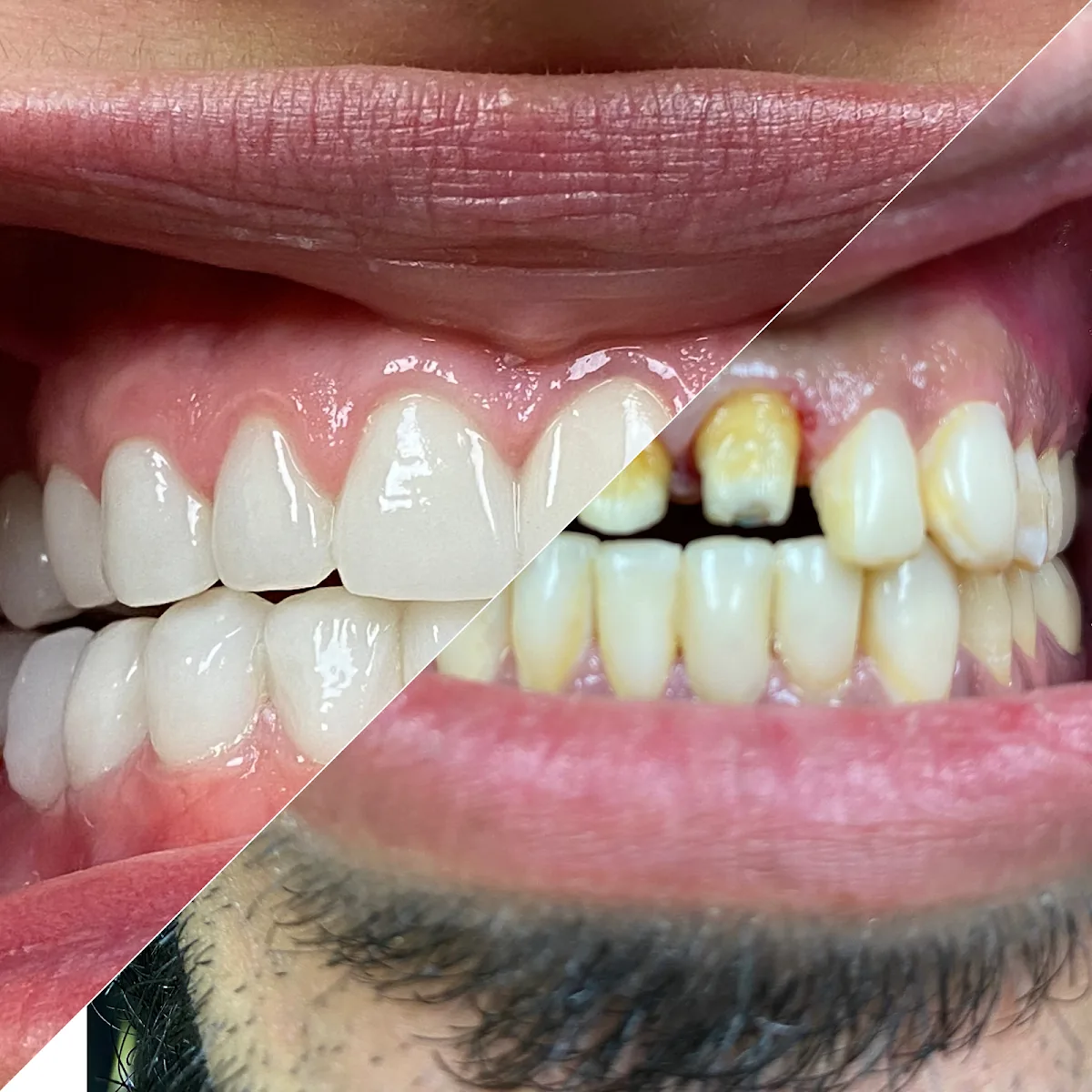 Bite Squad Dental of NYC | Pediatric and Family Dentist in Brooklyn photo 3