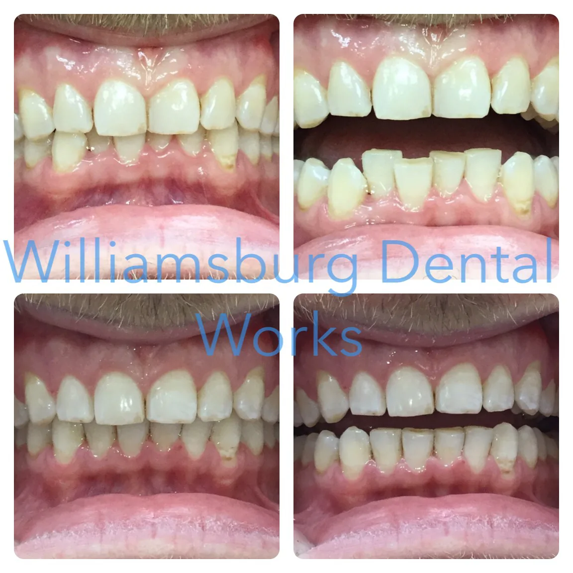 Williamsburg Dental Works photo 2