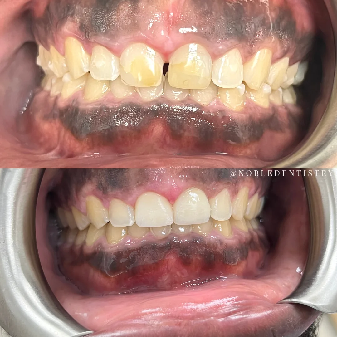 Noble Dental Care photo 2