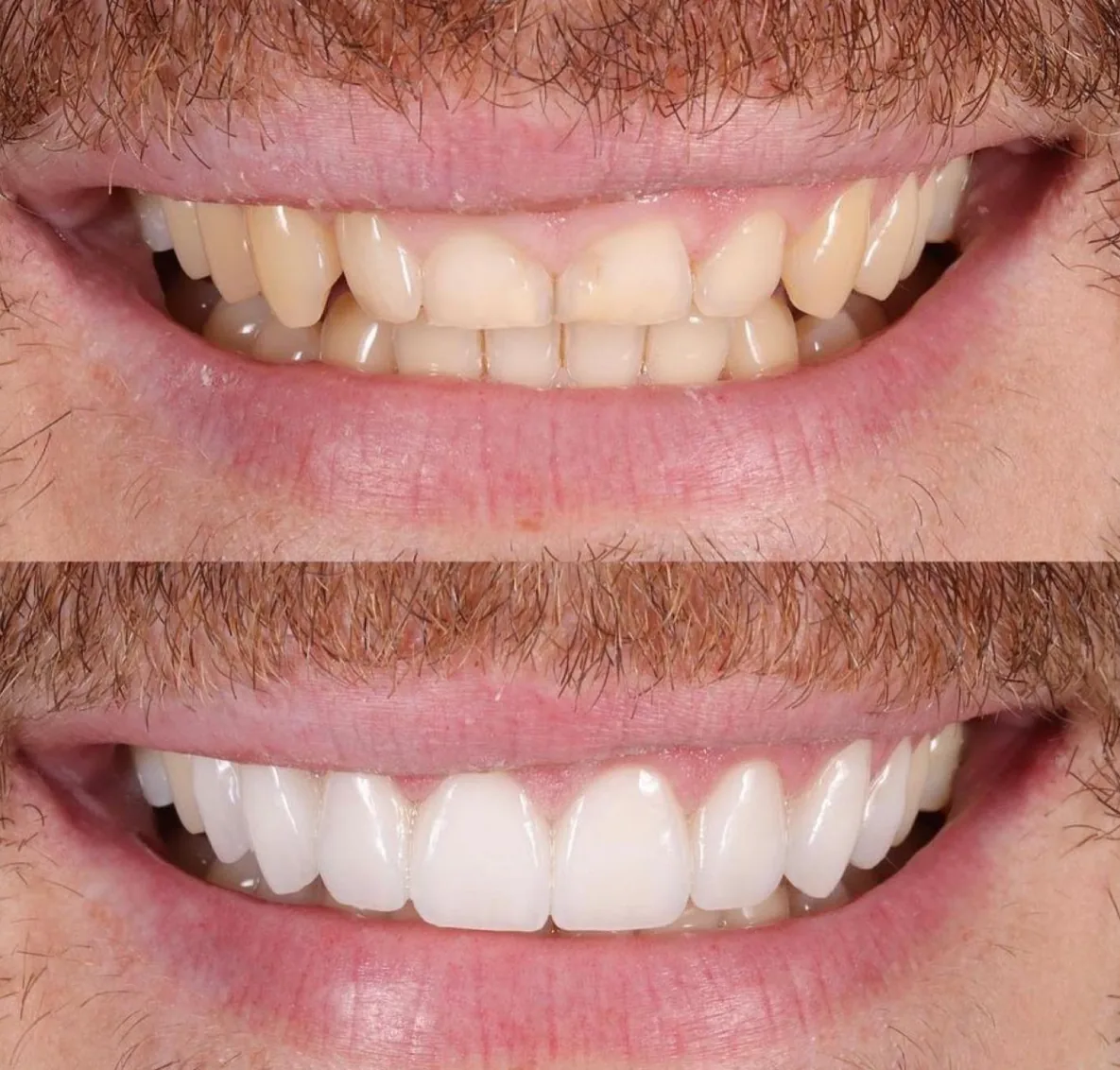 Dental Made Easy - Little Caribbean, Brooklyn photo 3