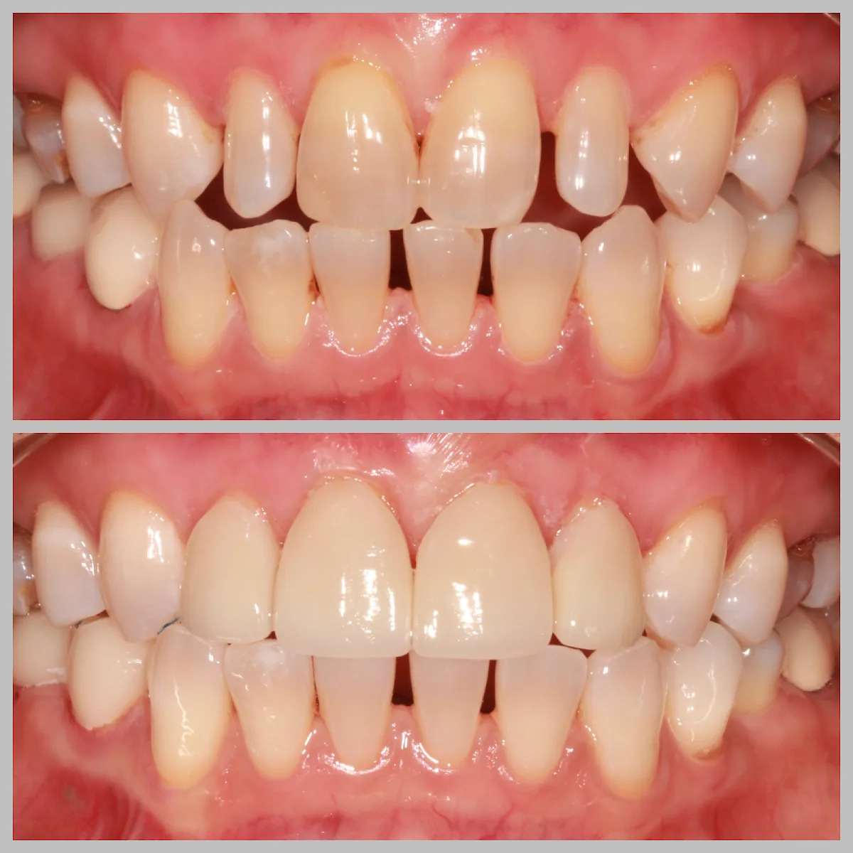 Bright Smile Dental of Brooklyn photo 2