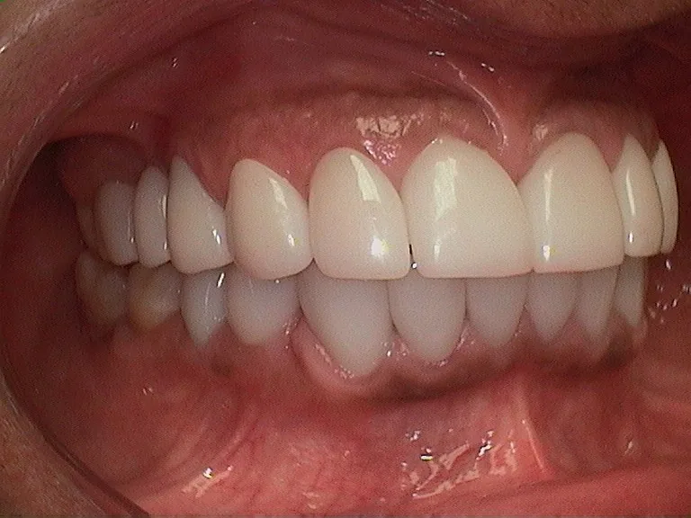 Bakersfield Smile Design | Dentist Dr. Kenneth W Krauss DDS photo 2