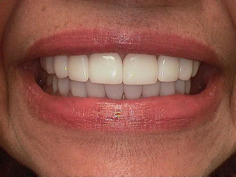 Bakersfield Smile Design | Dentist Dr. Kenneth W Krauss DDS photo 3