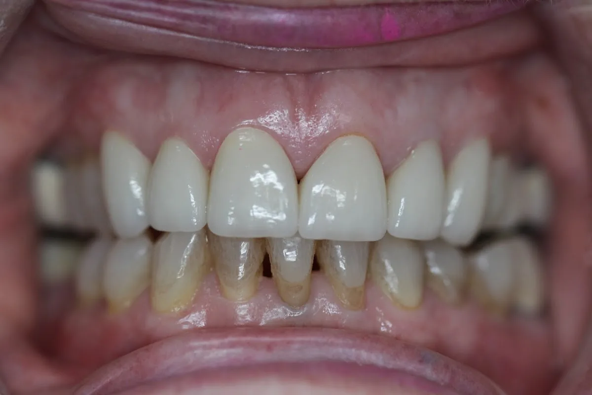 Dental Care of Oceanside photo 2
