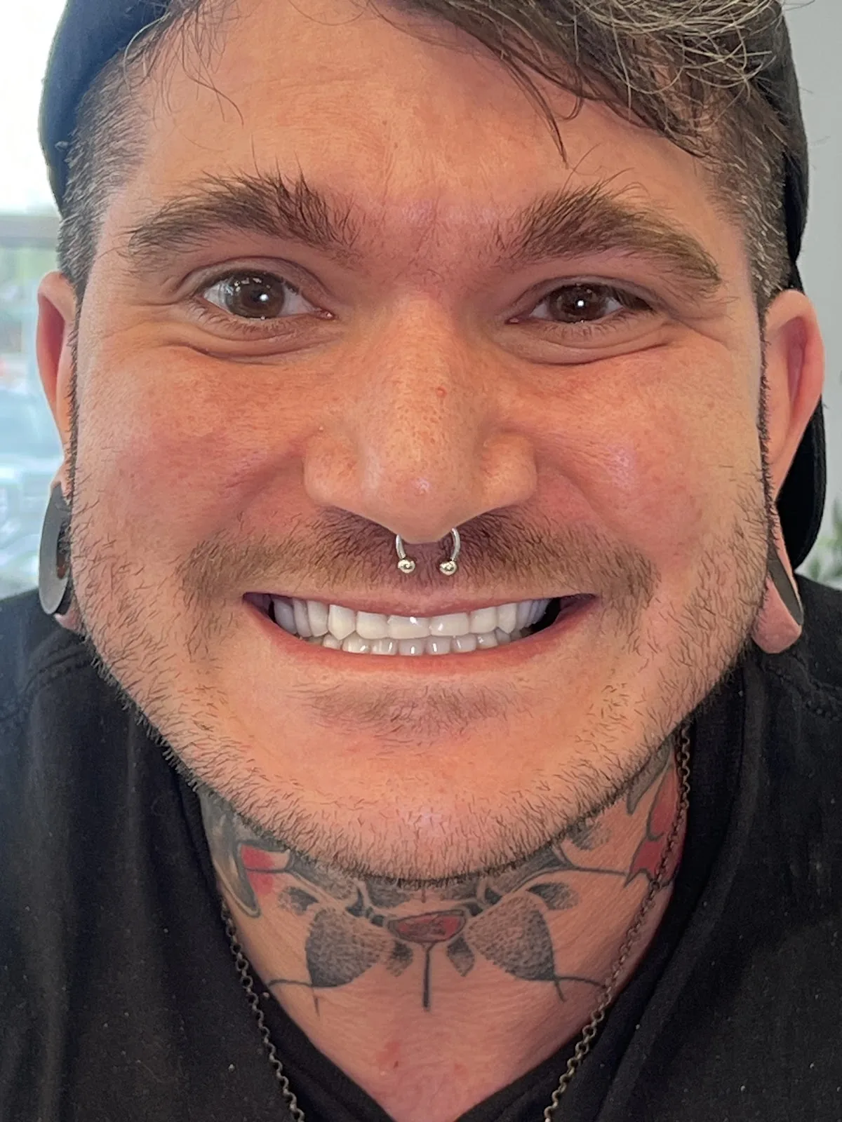 Nashville Dentures & Implants photo 3