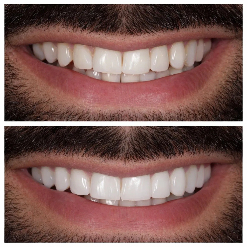 Nashville Dentures & Implants photo 2