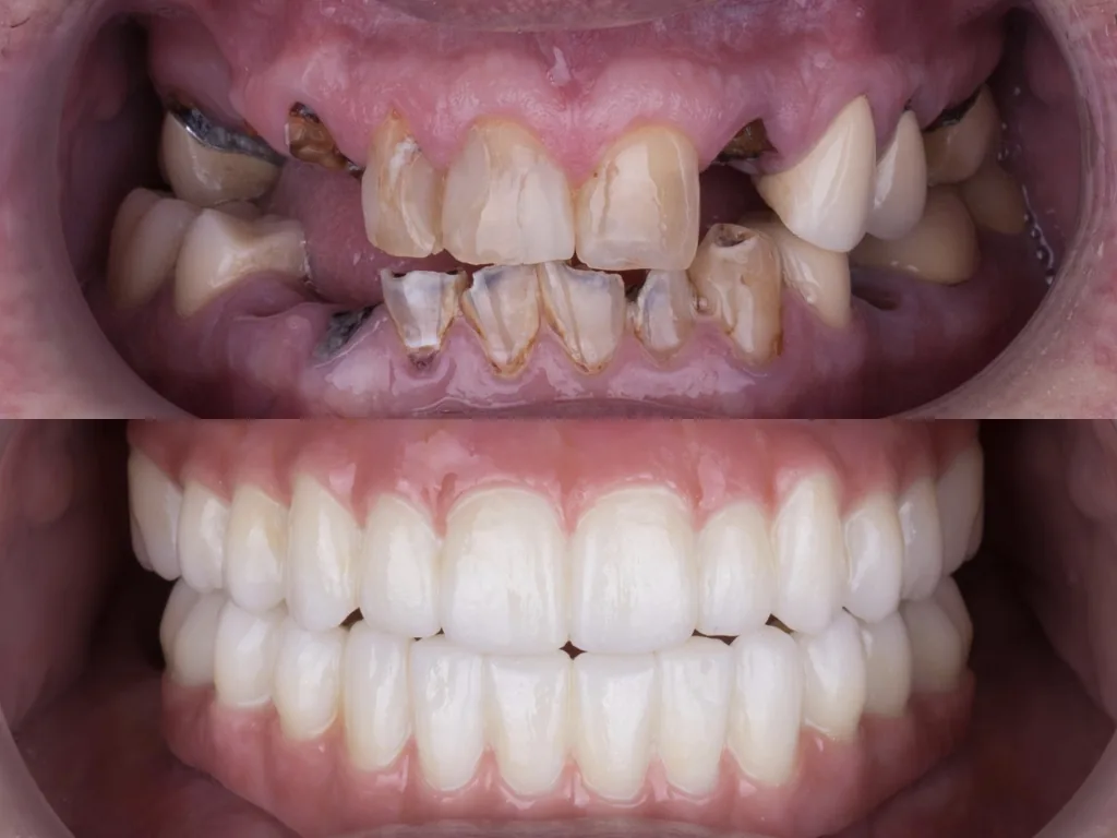 Same Day Smiles Nashville photo 2