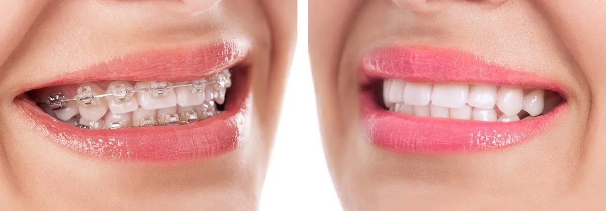 Implant Dental Works photo 3