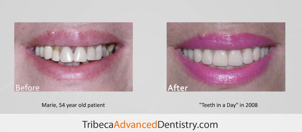 Tribeca Advanced Dentistry by Dr. Olga Malkin photo 4