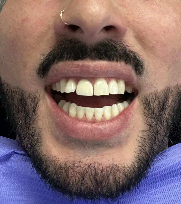 Restore Dental photo 3