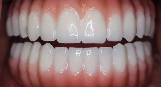 Implants 4 Life photo 4