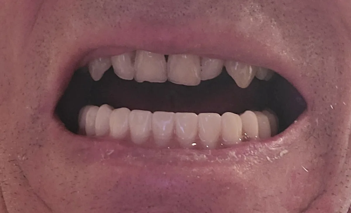 ClearChoice Dental Implant Center photo 5