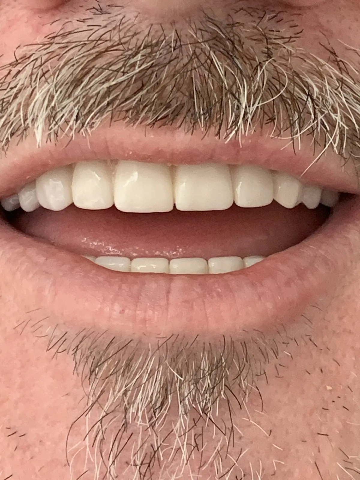 ClearChoice Dental Implant Center photo 2