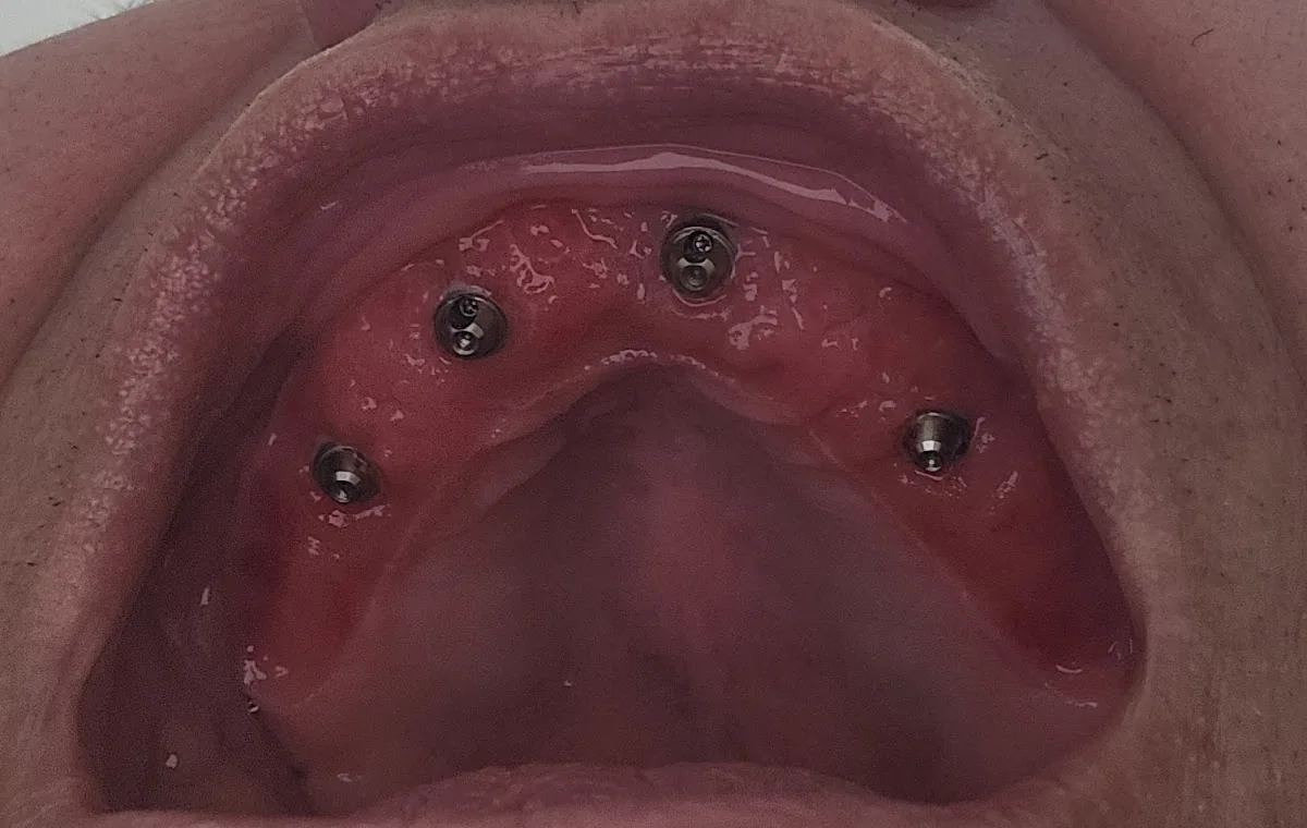 ClearChoice Dental Implant Center photo 4
