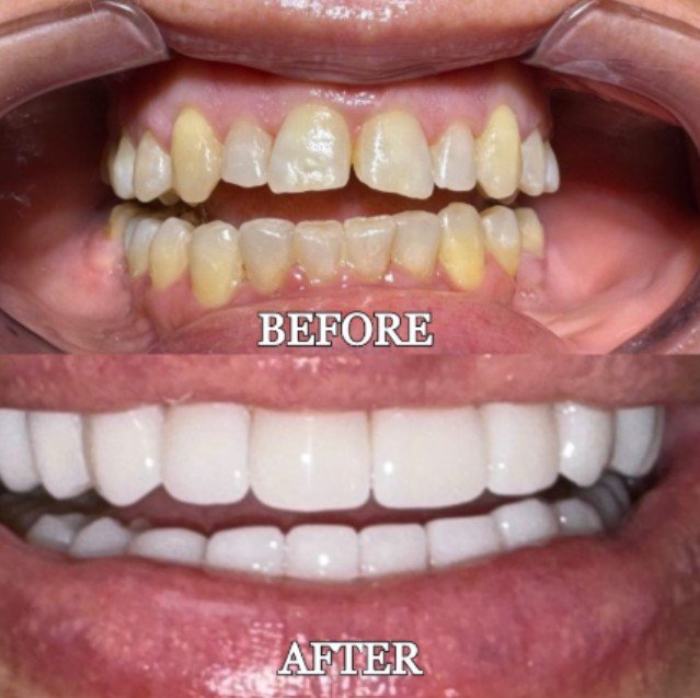 Vasallo Dental Office PA