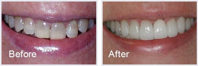 Steven W. Haywood, DDS