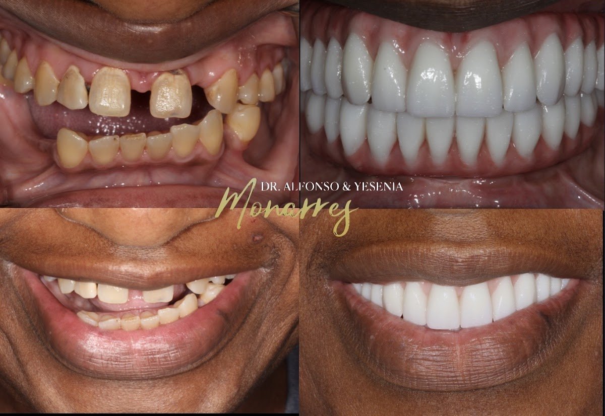 Alfonso Monarres DDS, MS, FACP.