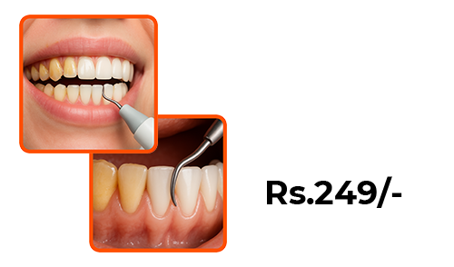 Sabka Dentist Whitefield