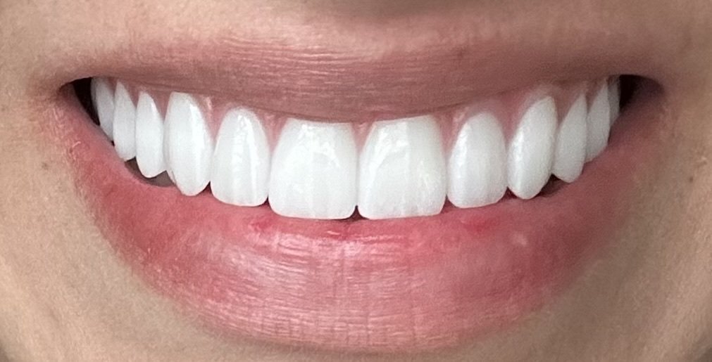 ClearChoice Dental Implant Center