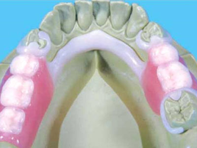 Denture Solutions at our Carlisle Lab