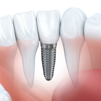 Oaklands Dental Surgery