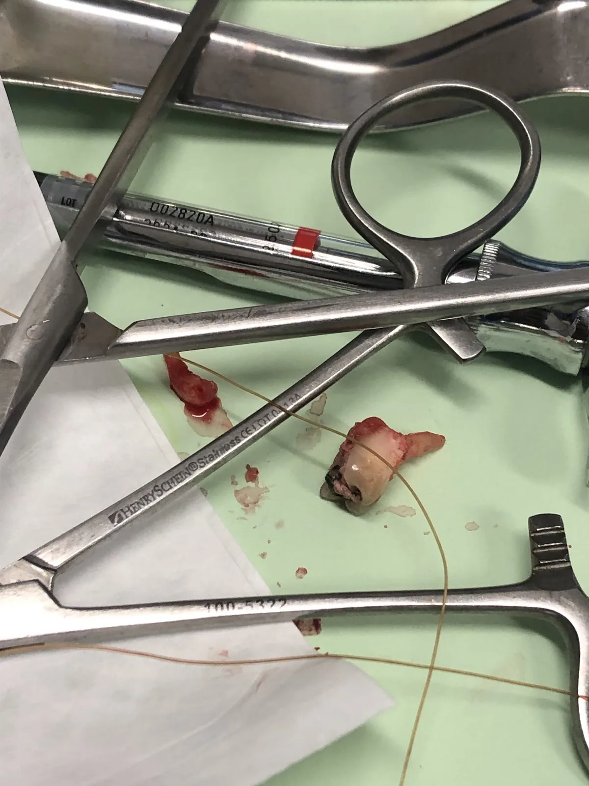 St. Marks Painless Dental photo 4