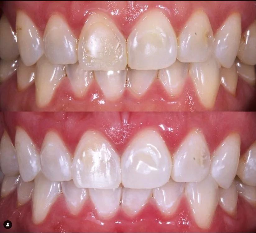Beam Dental Williamsburg photo 5