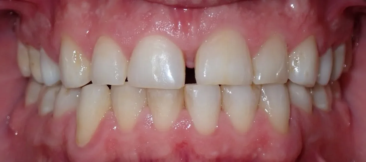 Mazel Family Dentistry photo 2
