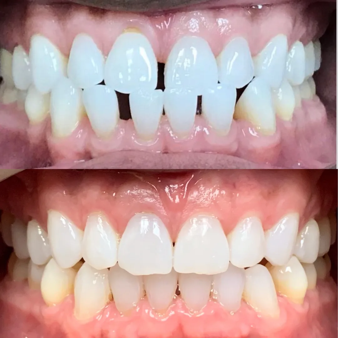 Italian Smiles Family and Cosmetic Dentistry photo 1