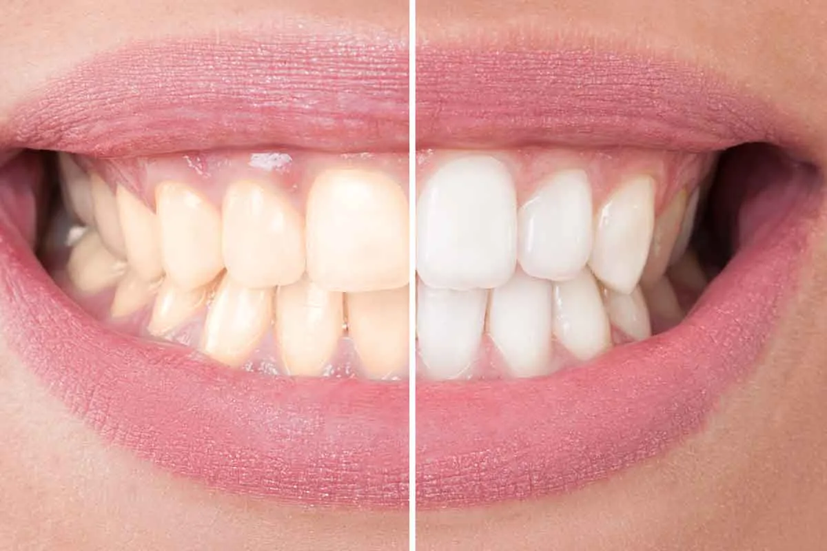 Dentist Brooklyn | Eco Dental photo 5