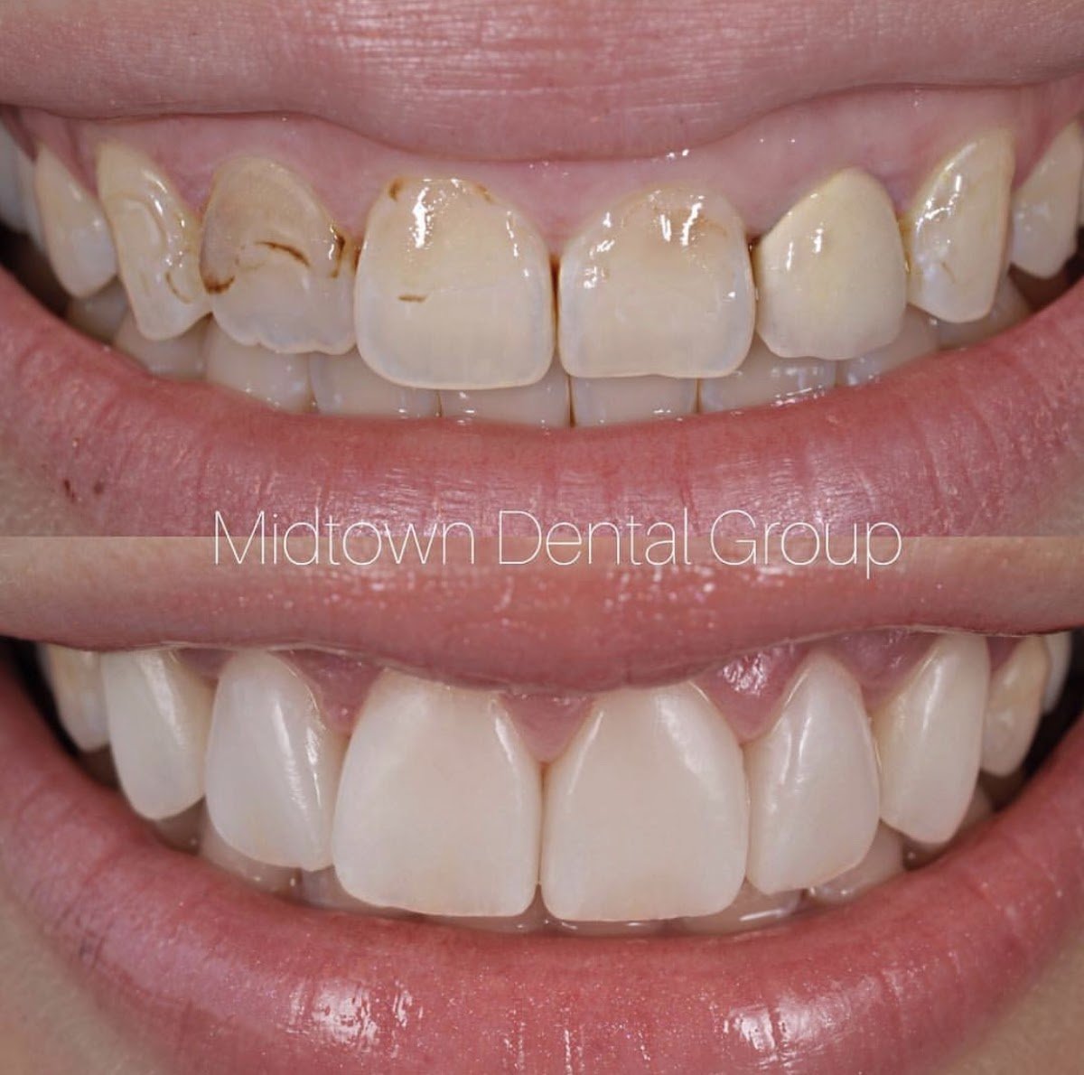 Midtown Dental Group West photo 5