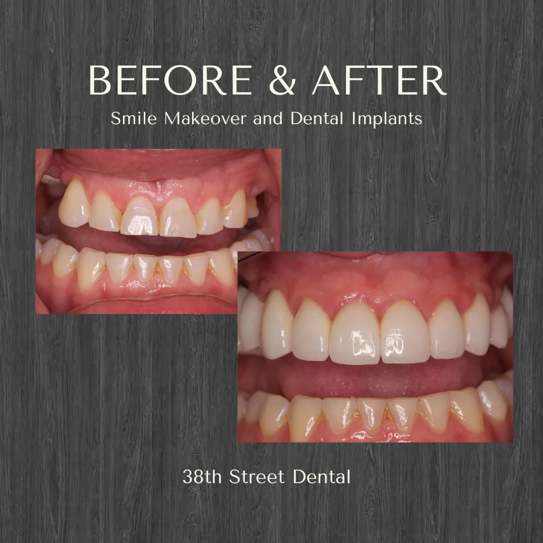 38th Street Dental photo 6
