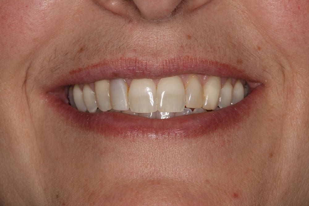 Aurora Family Dentistry