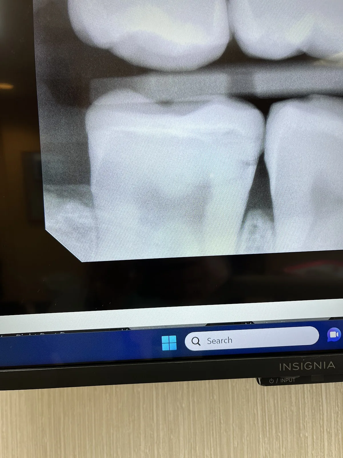 Cherry Creek Modern Dentistry photo 6