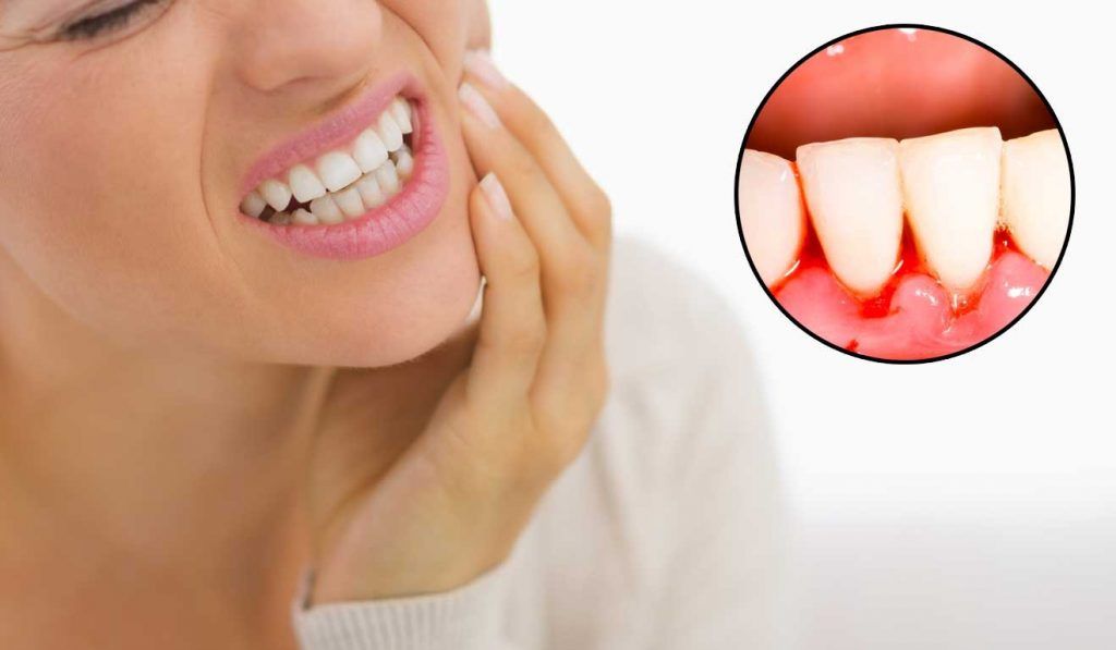 irritated gums