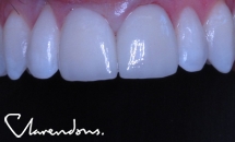 Clarendon Dental Spa
