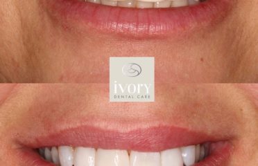Ivory Dental Care