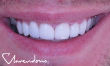 Clarendon Dental Spa