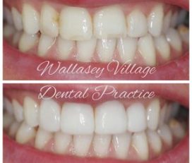 Wallasey Village Dental Practice