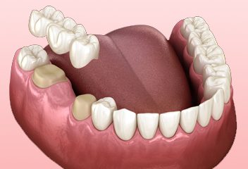 Genesis Dental Care