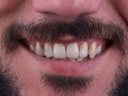 Mr R M M Browne – St Georges Dental Practice