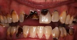 Wye Dental Surgery