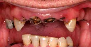 Green Tree Dental