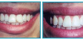 Denture Centre Ltd