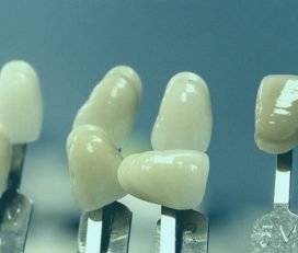 Perfect Pearls Dental Clinic