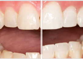 Liverpool Implant & Aesthetic Dental Spa