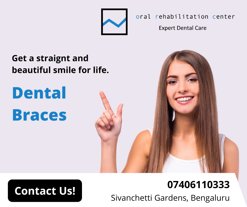 Oral rehabilitation center | Dental Implant Clinic